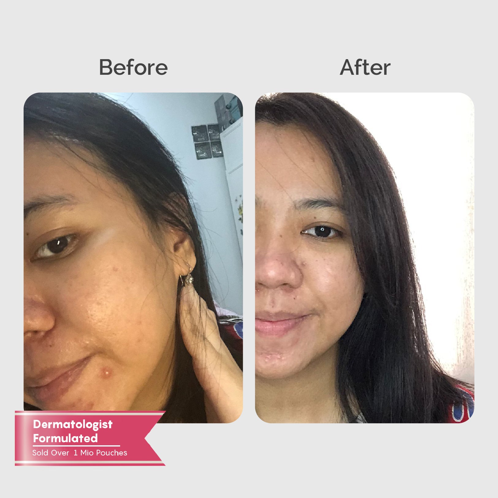 Youvit Collagen for Anti-Aging Bundle 30 Days (Save 7%)
